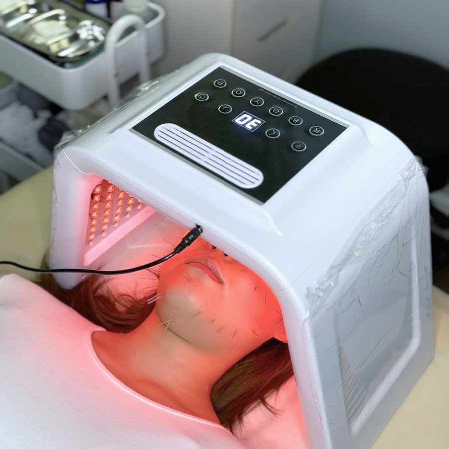 환자의 얼굴 위 붉은색 LED 광 테라피 돔